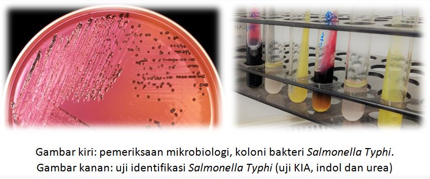 Bahaya Tersembunyi Salmonella Enterocolitis Keracunan makanan akibat bakteri Salmonella