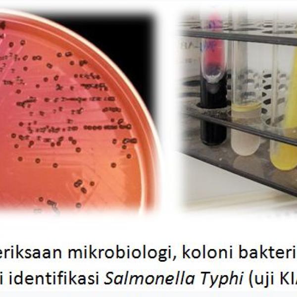 Bahaya Tersembunyi Salmonella Enterocolitis Keracunan makanan akibat bakteri Salmonella