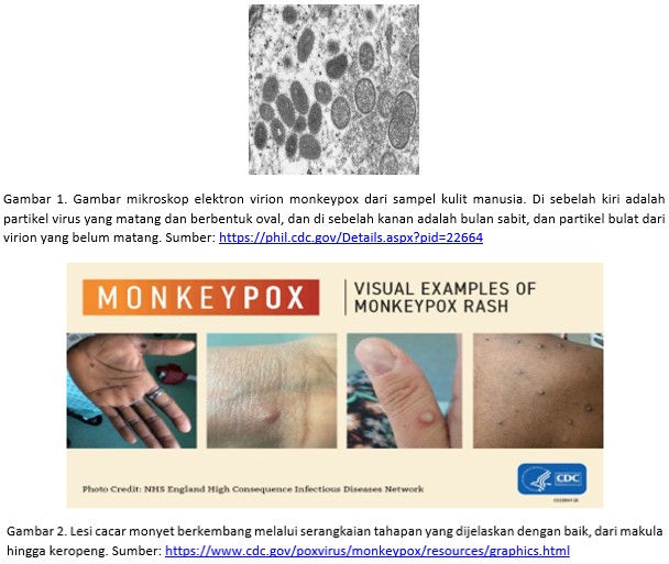 PENYAKIT CACAR MONYET (MONKEY POX)