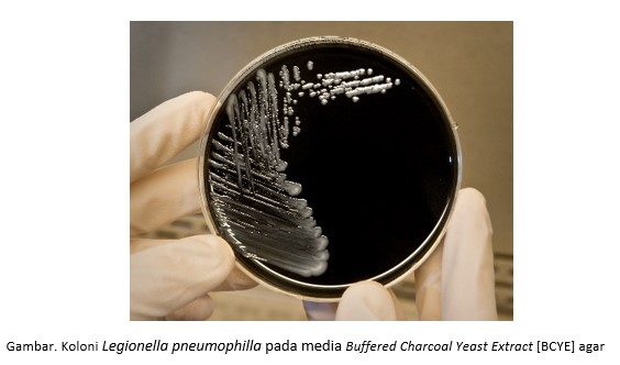 DETEKSI LABORATORIUM Legionella pneumophilla DARI SPESIMEN MANUSIA